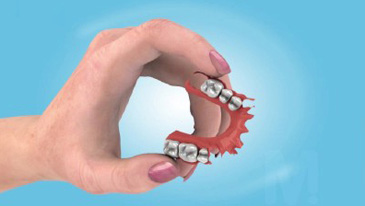 Dentures & Denture Stabilisation
